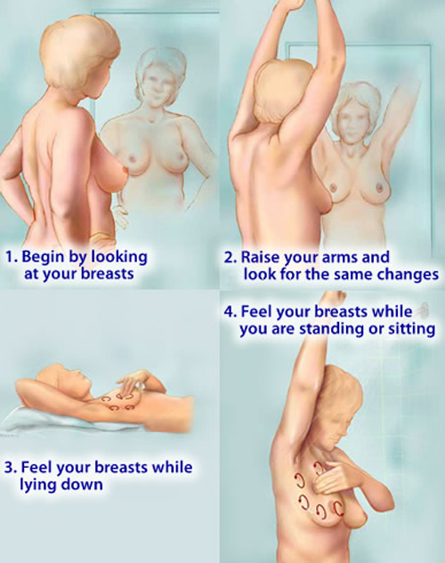 Cách làm Triệu chứng thường gặp ung thư vú giai đoạn đầu ngon.