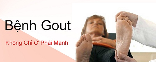 LàmBệnh Gout là gì? Hiểu như thế nào là bệnh Gout cho đúng tại nhà.